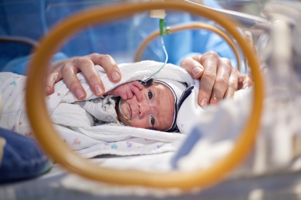 Funktionelle Echokardiographie bei Kindern und Neugeborenen