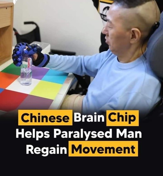 brain chip implant importance